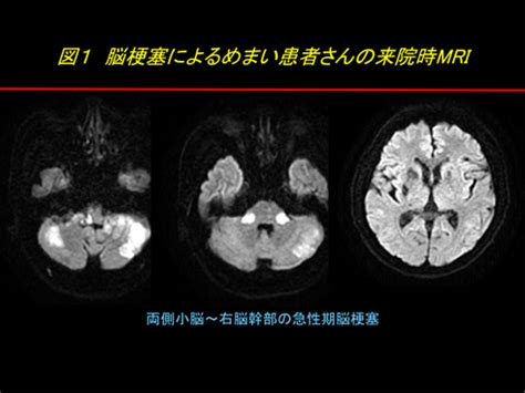 目眩|めまいとは｜（症状編） めまい｜神経内科の主な病 